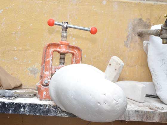 Prosthetics_Orthotics_Department