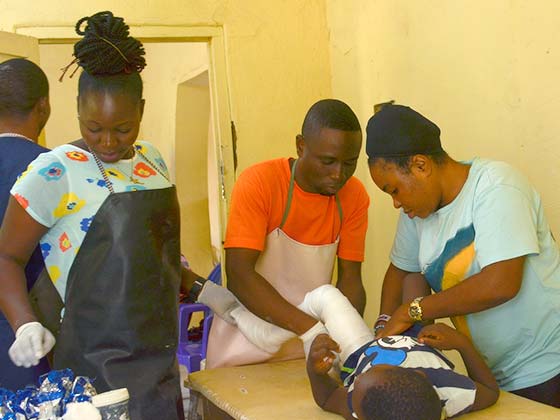 clubfoot nkst rehabilitation treatment